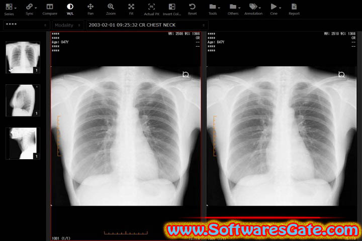 Fujidenolo Solutions SonicDICOM PACS : Version 3.15.1 (Latest Software)