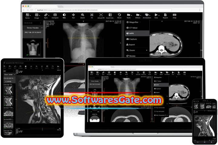 Fujidenolo Solutions SonicDICOM PACS : Version 3.15.1 (Latest Software)