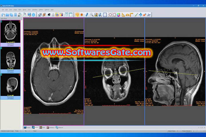 Sante DICOM Editor : Version 10.0.12 (Latest Software) Sante DICOM Editor : Version 10.0.12 (Latest Software)