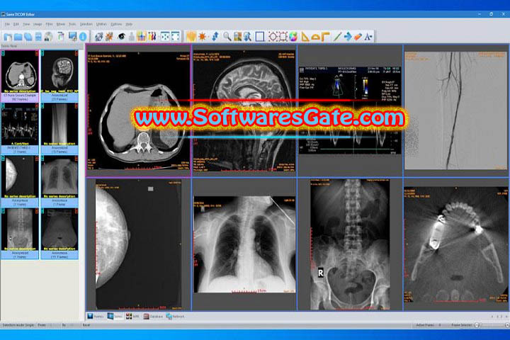 Sante DICOM Editor : Version 10.0.12 (Latest Software) Sante DICOM Editor : Version 10.0.12 (Latest Software)
