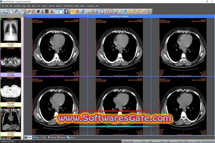 Sante DICOM Editor : Version 10.0.12 (Latest Software) Sante DICOM Editor : Version 10.0.12 (Latest Software)