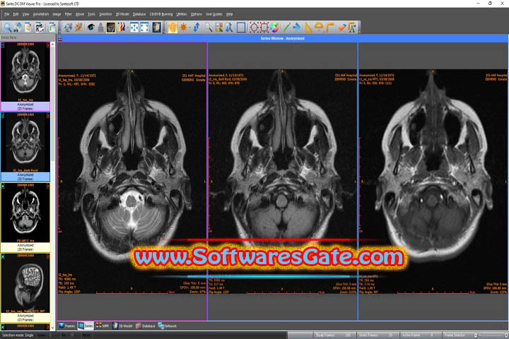 Sante DICOM Viewer Pro : Version 14.0.12 (Latest Software) Sante DICOM Viewer Pro : Version 14.0.12 (Latest Software)