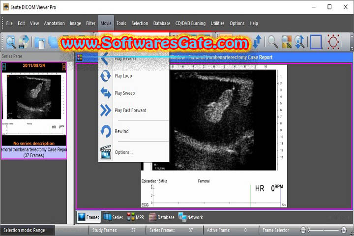Sante DICOM Viewer Pro : Version 14.0.12 (Latest Software) Sante DICOM Viewer Pro : Version 14.0.12 (Latest Software)
