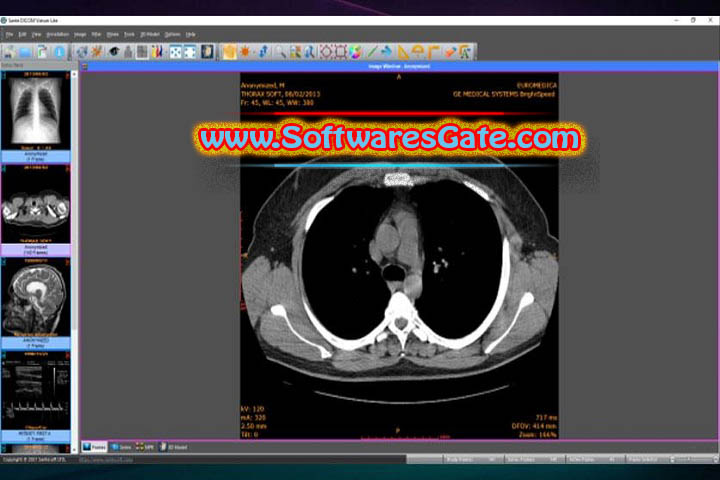 Sante PACS Server : Version 4.0.9 (Latest Software)
