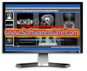 Sante PACS Server : Version 4.0.9 (Latest Software)